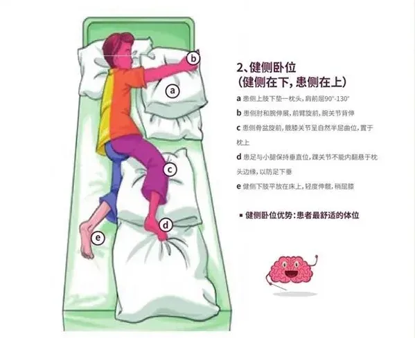 「脑卒中康复」这样做，科学且有效，提升生活质量