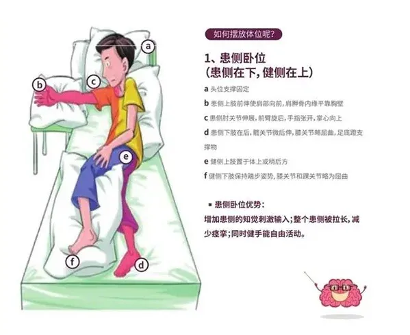 「脑卒中康复」这样做，科学且有效，提升生活质量